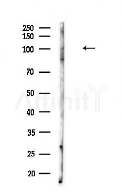 DNM3 Antibody - Western blot analysis of lysates from COLO205 cells(heat-shock,45min treatment), using DNM3 Antibody at 1/1000 dilution.