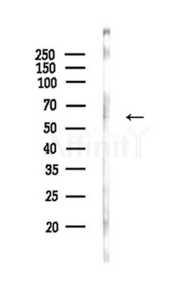 FADS1 Antibody - Western blot analysis of lysates from HepG2 cells(starvation,24h treatment), using FADS1 Antibody at 1/1000 dilution.