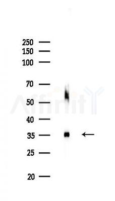 GALE Antibody - Western blot analysis of lysates from HUVEC cells(LPS,4h treatment), using GALE Antibody at 1/1000 dilution.