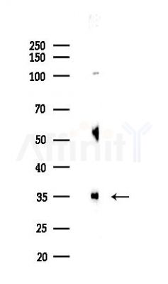 GALE Antibody - Western blot analysis of lysates from COLO205 cells(heat-shock,45min treatment), using GALE Antibody at 1/1000 dilution.