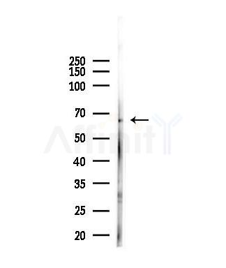 GSPT2 Antibody - Western blot analysis of lysates from Mouse liver, using GSPT2 Antibody at 1/1000 dilution.