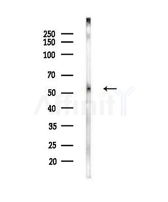 MGAT1 Antibody - Western blot analysis of lysates from EC304 cells(heat-shock,45min treatment), using MGAT1 Antibody at 1/1000 dilution.