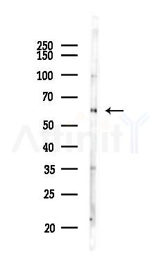 PACSIN2 Antibody - Western blot analysis of lysates from HepG2 cells(heat-shock,45min treatment), using PACSIN2 Antibody at 1/1000 dilution.