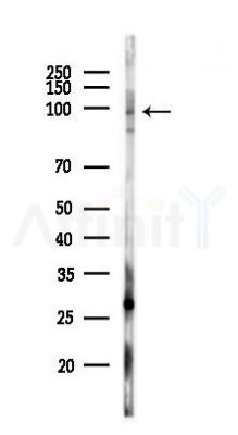 PDE6 beta Antibody - Western blot analysis of lysates from Rat brain, using PDE6 beta Antibody at 1/1000 dilution.