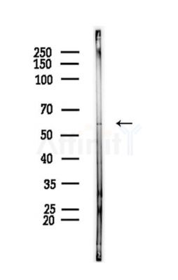 PRPF4 Antibody - Western blot analysis of lysates from PC12 cells, using PRPF4 Antibody at 1/1000 dilution.
