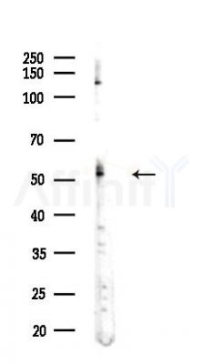 PSMC1 Antibody - Western blot analysis of lysates from COLO205 cells(heat-shock,45min treatment), using PSMC1 Antibody at 1/1000 dilution.