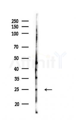 PSPH Antibody - Western blot analysis of lysates from HUVEC cells(LPS,4h treatment), using PSPH Antibody at 1/1000 dilution.