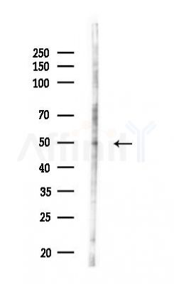 RARG Antibody - Western blot analysis of lysates from HUVEC cells(LPS,4h treatment), using RARG Antibody at 1/1000 dilution.