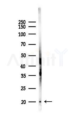 REEP1 Antibody - Western blot analysis of lysates from EC304 cells(UV,30min treatment), using REEP1 Antibody at 1/1000 dilution.