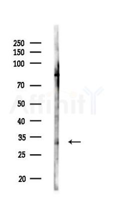 SDHB Antibody - Western blot analysis of lysates from HUVEC cells(LPS,4h treatment), using SDHB Antibody at 1/1000 dilution.