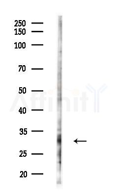 SDHB Antibody - Western blot analysis of lysates from COLO205 cells(heat-shock,45min treatment), using SDHB Antibody at 1/1000 dilution.