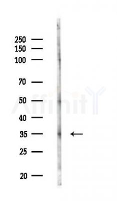 SIRT6 Antibody - Western blot analysis of lysates from HUVEC cells(LPS,4h treatment), using SIRT6 Antibody at 1/1000 dilution.