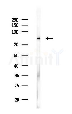 SUZ12 Antibody - Western blot analysis of lysates from HUVEC cells(LPS,4h treatment), using SUZ12 Antibody at 1/1000 dilution.