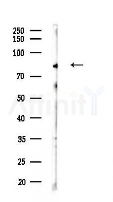 SUZ12 Antibody - Western blot analysis of lysates from COLO205 cells(heat-shock,45min treatment), using SUZ12 Antibody at 1/1000 dilution.