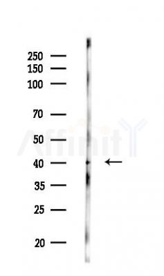 TALDO1 Antibody - Western blot analysis of lysates from HUVEC cells(LPS,4h treatment), using TALDO1 Antibody at 1/1000 dilution.
