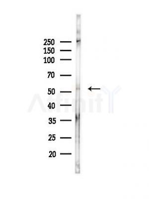 TRIM15 Antibody - Western blot analysis of lysates from Hela cells(UV, 30min treatment), using TRIM15 Antibody at 1/1000 dilution.