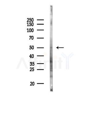 TRIM15 Antibody - Western blot analysis of lysates from HepG2 cells(starvation,24h treatment), using TRIM15 Antibody at 1/1000 dilution.