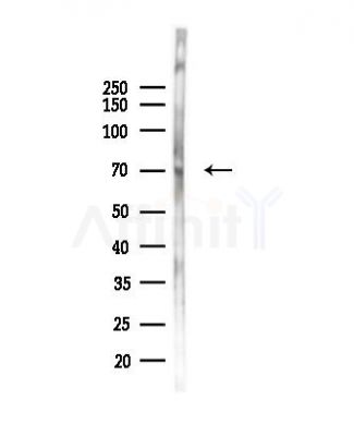 TRPV6 Antibody - Western blot analysis of lysates from Mouse liver, using TRPV6 Antibody at 1/1000 dilution.
