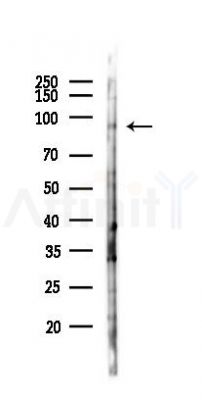 VPS35 Antibody - Western blot analysis of lysates from 293 cells(UV,30min treatment), using VPS35 Antibody at 1/1000 dilution.