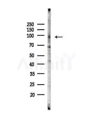 VPS41 Antibody - Western blot analysis of lysates from Hela cells(UV, 30min treatment), using VPS41 Antibody at 1/1000 dilution.