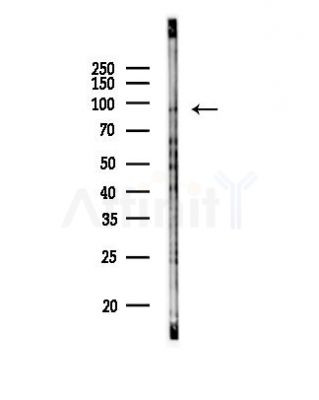 VPS41 Antibody - Western blot analysis of lysates from HepG2 cells(starvation,24h treatment), using VPS41 Antibody at 1/1000 dilution.