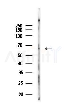 VPS45 Antibody - Western blot analysis of lysates from Rat brain, using VPS45 Antibody at 1/1000 dilution.