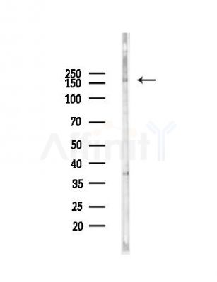 WDR19/IFT144 Antibody - Western blot analysis of lysates from Hela cells(UV,30min treatment), using WDR19/IFT144 Antibody at 1/1000 dilution.