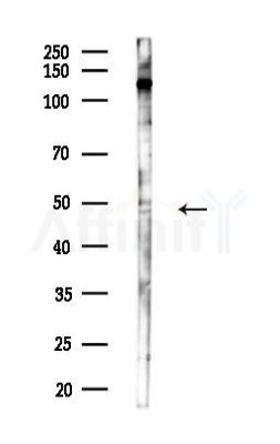 AADAT Antibody - Western blot analysis of lysates from COLO205 cells(heat-shock,45min treatment), using AADAT Antibody at 1/1000 dilution.