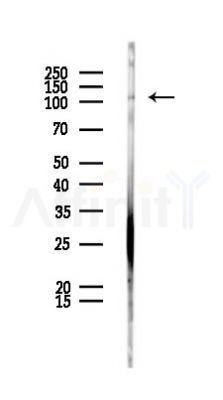 AP2B1 Antibody - Western blot analysis of lysates from PC12 cells, using AP2B1 Antibody at 1/1000 dilution.
