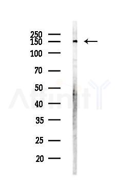 BRD8 Antibody - Western blot analysis of lysates from LoVo cells(heat-shock,45min treatment), using BRD8 Antibody at 1/1000 dilution.