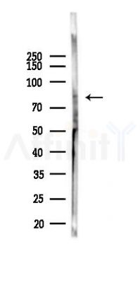 C17orf28 Antibody - Western blot analysis of lysates from HUVEC cells(starvation,24h treatment), using C17orf28 Antibody at 1/1000 dilution.