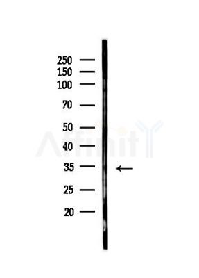 C1orf77 Antibody - Western blot analysis of lysates from Hela cells(UV, 30min treatment), using C1orf77 Antibody at 1/1000 dilution.