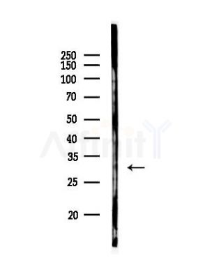 C1orf77 Antibody - Western blot analysis of lysates from HepG2 cells(starvation,24h treatment), using C1orf77 Antibody at 1/1000 dilution.