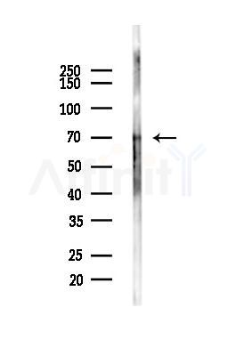 C4BPA Antibody - Western blot analysis of lysates from COLO205 cells(LPS,4h treatment), using C4BPA Antibody at 1/1000 dilution.