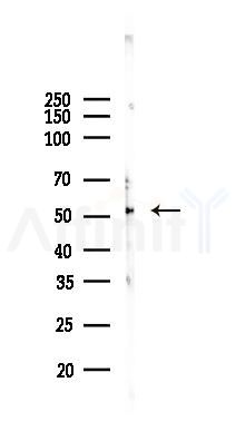 CathepsinF Antibody - Western blot analysis of lysates from K562 cells(UV, 30min treatment), using CathepsinF Antibody at 1/1000 dilution.