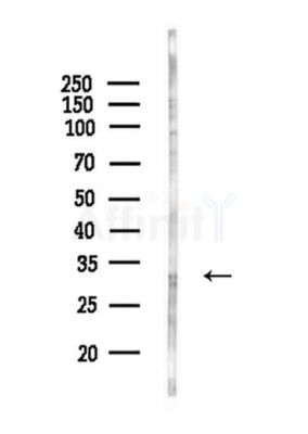 CNOT8 Antibody - Western blot analysis of lysates from HepG2 cells(starvation,24h treatment), using CNOT8 Antibody at 1/1000 dilution.