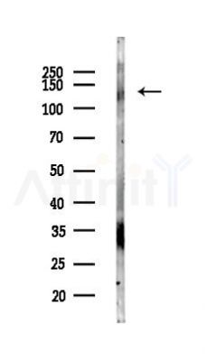 CNTN1 Antibody - Western blot analysis of lysates from Mouse liver, using CNTN1 Antibody at 1/1000 dilution.
