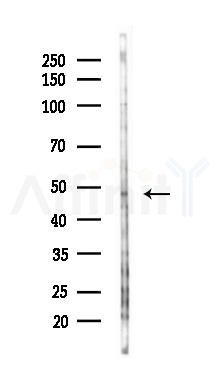 Connexin-46 Antibody - Western blot analysis of lysates from COLO205 cells(heat-shock,45min treatment), using Connexin-46 Antibody at 1/1000 dilution.