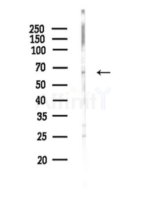 CPNE6 Antibody - Western blot analysis of lysates from HepG2 cells(starvation,24h treatment), using CPNE6 Antibody at 1/1000 dilution.