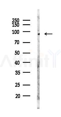 CRACR2A Antibody - Western blot analysis of lysates from LoVo cells(heat-shock,45min treatment), using CRACR2A Antibody at 1/1000 dilution.