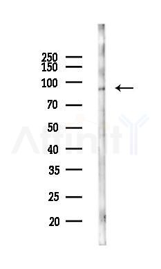 CRACR2A Antibody - Western blot analysis of lysates from COLO205 cells(LPS,4h treatment), using CRACR2A Antibody at 1/1000 dilution.