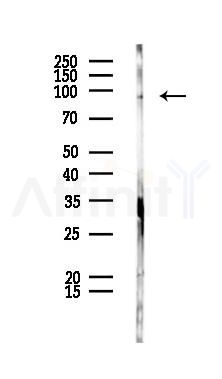 CRACR2A Antibody - Western blot analysis of lysates from PC12 cells, using CRACR2A Antibody at 1/1000 dilution.