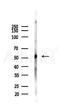 DDX6 Antibody - Western blot analysis of lysates from COLO205 cells(LPS,4h treatment), using DDX6 Antibody at 1/1000 dilution.