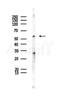 DDX6 Antibody - Western blot analysis of lysates from PC12 cells, using DDX6 Antibody at 1/1000 dilution.