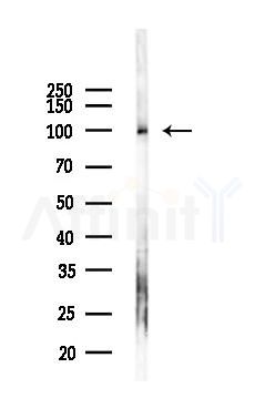 DNM2 Antibody - Western blot analysis of lysates from Mouse liver, using DNM2 Antibody at 1/1000 dilution.