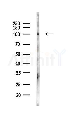 DNM2 Antibody - Western blot analysis of lysates from LoVo cells(heat-shock,45min treatment), using DNM2 Antibody at 1/1000 dilution.