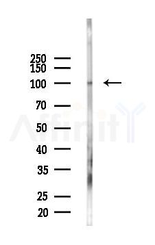 DNM2 Antibody - Western blot analysis of lysates from COLO205 cells(LPS,4h treatment), using DNM2 Antibody at 1/1000 dilution.