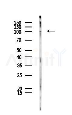 DNM2 Antibody - Western blot analysis of lysates from PC12 cells, using DNM2 Antibody at 1/1000 dilution.