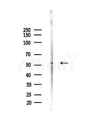 DNPEP Antibody - Western blot analysis of lysates from Mouse testis, using DNPEP Antibody at 1/1000 dilution.