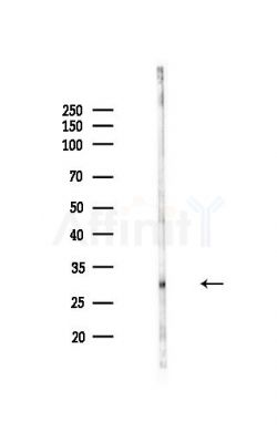 EVI2A Antibody - Western blot analysis of lysates from MDA-MB-231 cells(heat-shock,45min treatment), using EVI2A Antibody at 1/1000 dilution.